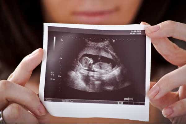 Woman holding ultrasound picture of her baby - will she overcome miscarriage fears, pregnancy fears and show her ultrasound to the world?